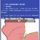 最近【符离限行图,符离一号地最新消息】